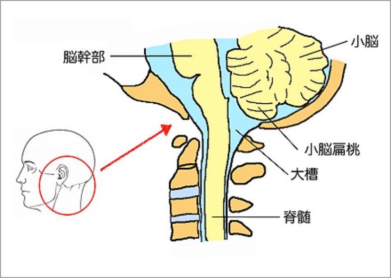 頭蓋頚椎移行部図（正常）