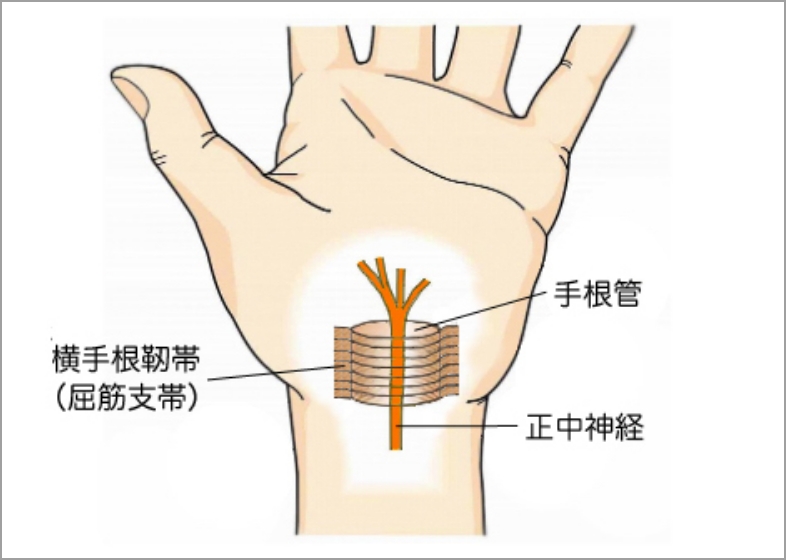 手根管の構造