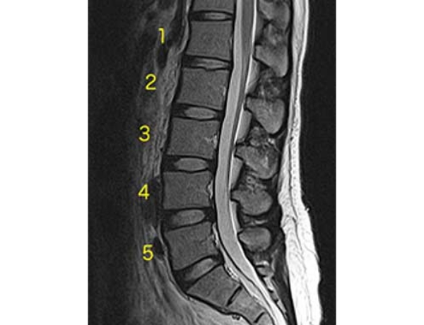 28歳女性 腰椎（正常所見）